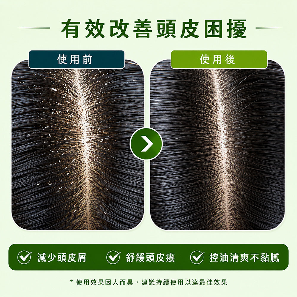 油頭byebye淨化頭皮洗髮精