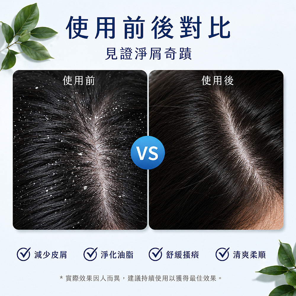 <薄荷+尤加利>強效淨屑冰清洗髮露